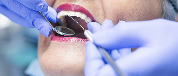 Best Same-Day Emergency Dental Services in Bloomfield Hills, MI